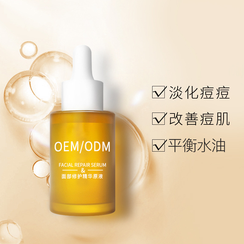 云浮市_祛痘精华原液OEM